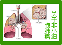 关于非小细胞肺癌